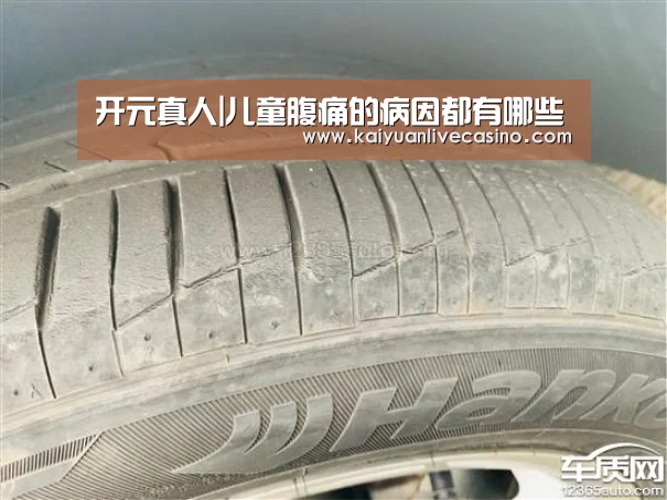 开元真人|儿童腹痛的病因都有哪些(图1) 开元电竞